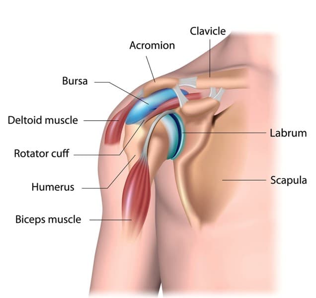 Labeled anatomical diagram of the shoulder showing the clavicle, acromion, bursa, deltoid muscle, rotator cuff, humerus, biceps muscle, labrum, and scapula